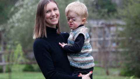 Madre con su hijo que vive con Sindrome de Apert