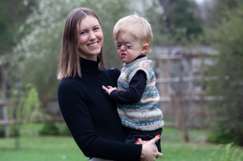 Madre con su hijo que vive con Sindrome de Apert