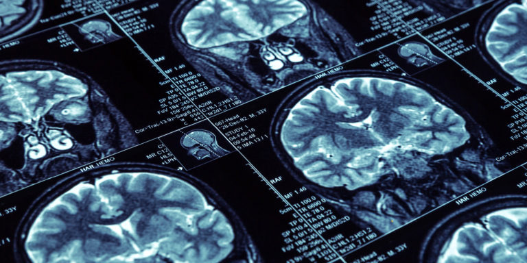 El primer y único tratamiento oral de corta duración para la Esclerosis Múltiple
