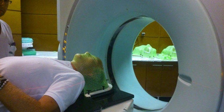 RADIOTERAPIA: TRATAMIENTO NECESARIO Y A VECES DISCAPACITANTE