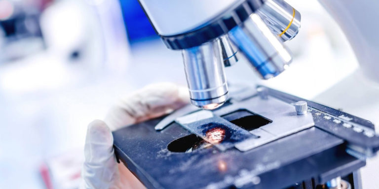 Descubren enfermedad autoinmune relacionada con el cáncer de testículo.