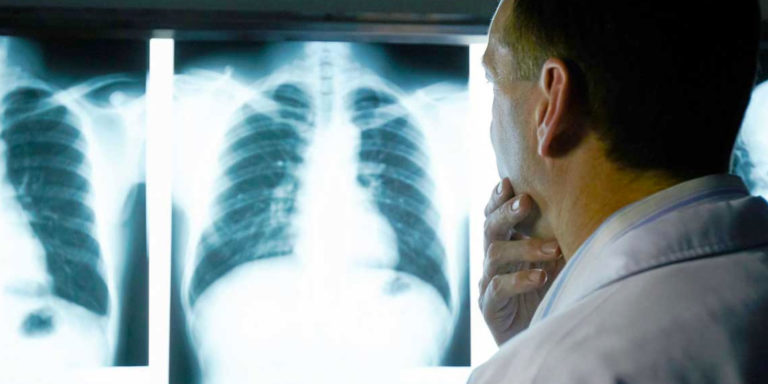 Centro Médico  INCAN unidos contra el cáncer de pulmón.