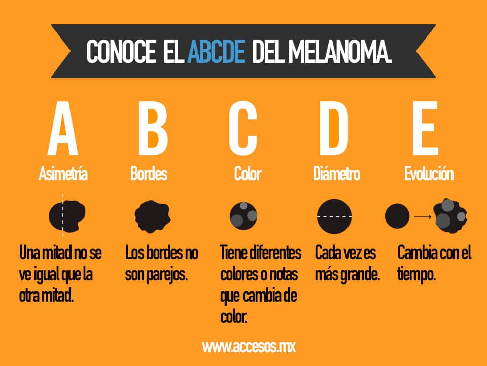 melanoma infografia