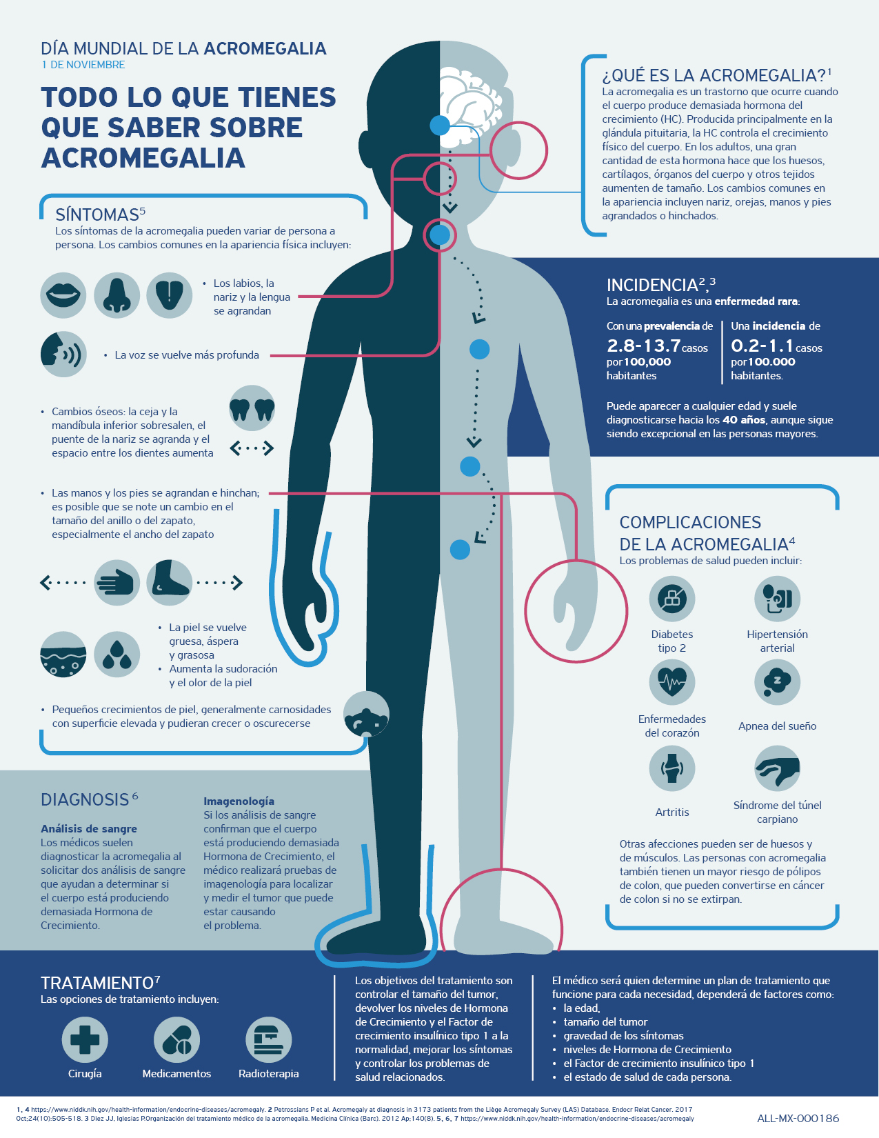 acromgalia infografía