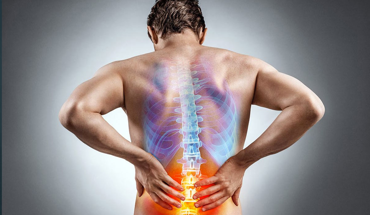 espondilitis