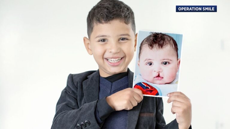 operation smile