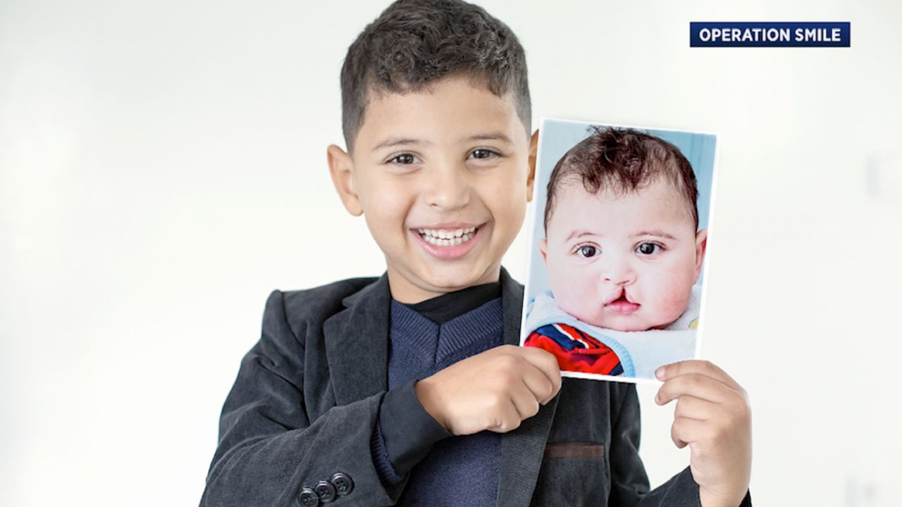 operation smile